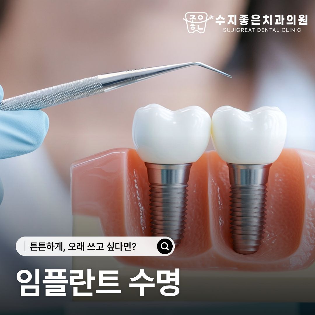 임플란트 치아 모형과 치과 기구 — 튼튼하게, 오래 쓰고 싶다면? 임플란트 수명