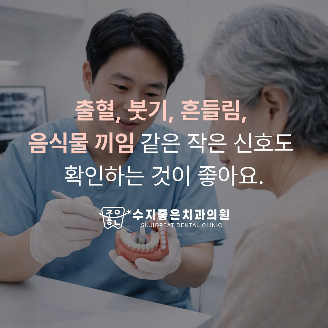 치과의사가 치아 모형으로 환자에게 설명 — 출혈, 붓기, 흔들림, 음식물 끼임 같은 작은 신호도 확인하는 것이 좋아요